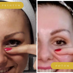 Kurz Čelo a okolie očí 26.4.2026 v Žiline s BONUSOM